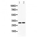 Fas Ligand Antibody