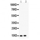 Fatty Acid Binding Protein 5 Antibody