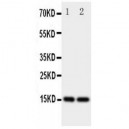 Fatty Acid Binding Protein 5 Antibody