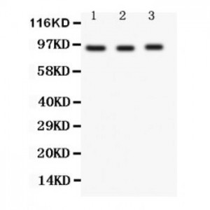 FER Antibody