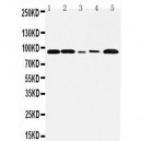 FGFR1 Antibody