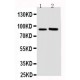 FGFR3 Antibody