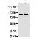 FGFR3 Antibody