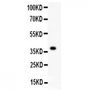 FGFR4  Antibody