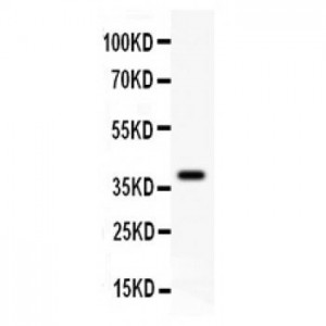 FHIT  Antibody