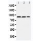 Fibroblast activation protein, alpha Antibody