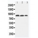 Fibroblast activation protein, alpha Antibody