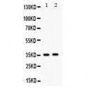 Fos B Antibody