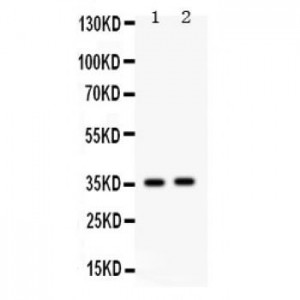 Fos B Antibody