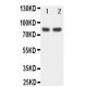 FOXP1 Antibody