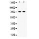 Frizzled homolog 1  Antibody