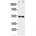 GABA A Receptor alpha 1 Antibody