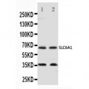 GABA Transporter 1/GAT 1 Antibody