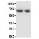 GAD65 Antibody