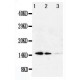 Galectin 1 Antibody