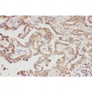 Galectin 3  Antibody