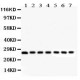 Galectin 3  Antibody