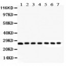 Galectin 3  Antibody