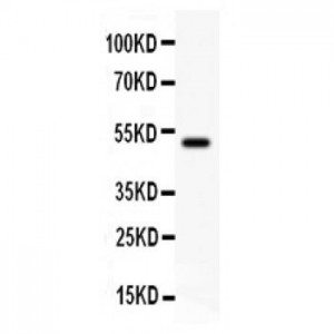 gamma Catenin  Antibody