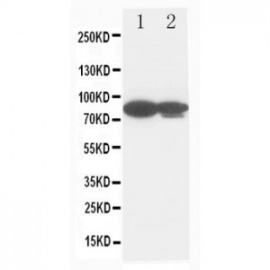 gamma Catenin Antibody