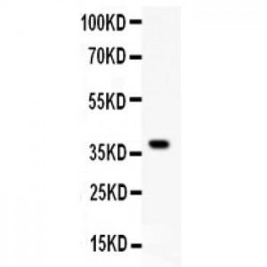 GCLC  Antibody