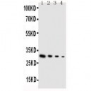 GDNF Antibody