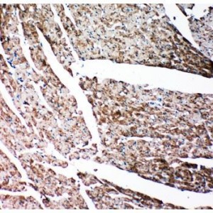 Gelsolin Antibody