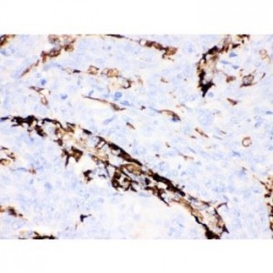 Gelsolin Antibody (monoclonal)