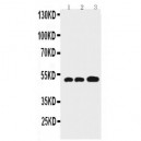 GFAP Antibody