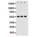 Glucose Transporter 5 GLUT5 Antibody