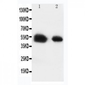 Glucose Transporter 8 Antibody