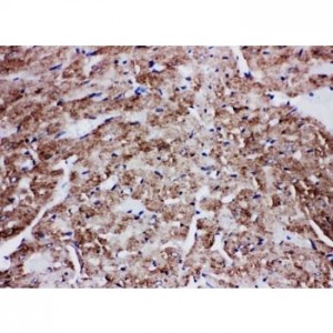 Glucose Transporter GLUT4 Antibody