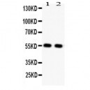 GLUT4  Antibody