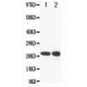 Glutathione Peroxidase 2 Antibody