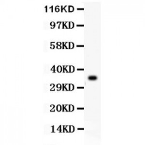 GPX1  Antibody