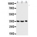 Granzyme A Antibody