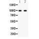 GRIA2  Antibody