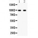 GRIA2  Antibody