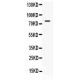 GRP78 BiP  Antibody