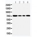 GRP78 BiP Antibody