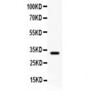 GST3/GST pi  Antibody