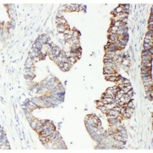 GST3/GST pi Antibody