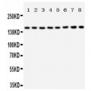 Hamartin Antibody