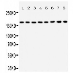 Hamartin Antibody