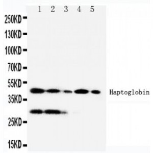 Haptoglobin Antibody