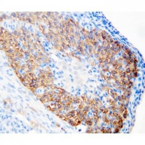 hCG receptor Antibody