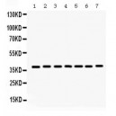 HDAC11  Antibody