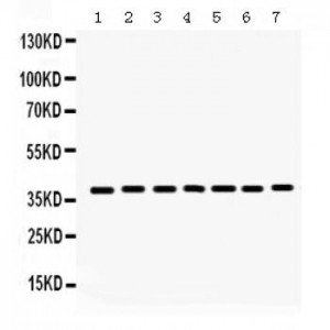 HDAC11  Antibody