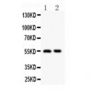 HDAC2 Antibody