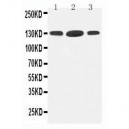 HDAC6 Antibody